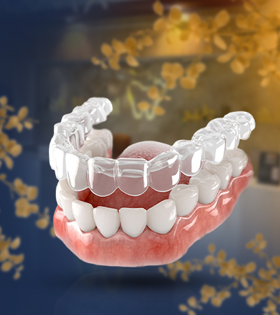 تقويم الأسنان الشفاف